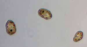 Photo of the micro-alga Heterosigma akashiwo taken with a phase contrast microscope.